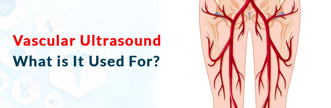 Vascular Ultrasound: What is It Used For?